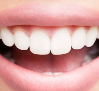 Dentist Teeth Whitening Chicago - Beautiful woman Smile