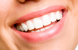 Teeth Whitening in Chicago - Woman with smile