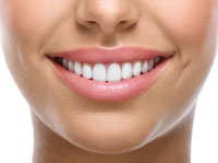 Teeth Whitening Options Chicago - Teeth Whitening with Woman Smile