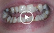 Patient Testimonial Video 01