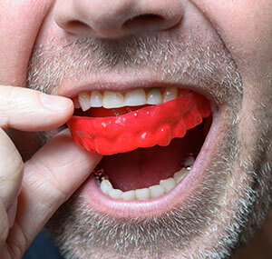 A man wearing mouth guard