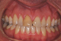 Periodontist Farmington Hills - Gallery Image 09