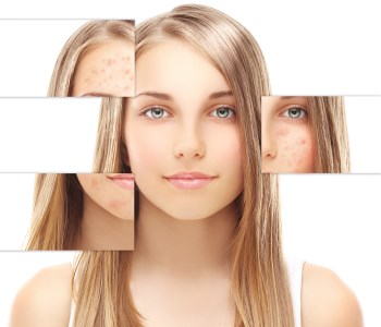 Stockton residents benefit from safe, effective types of  dermal fillers to restore youthful volume