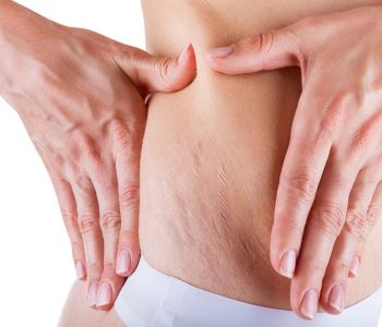 YAG laser resurfacing for Stockton area patients
