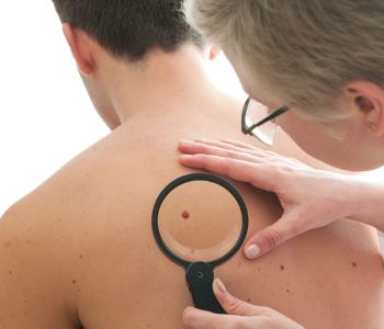 The importance of a skin cancer screening session in Stockton
