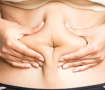 Fat removal from Liposuction Specialist in Stockton