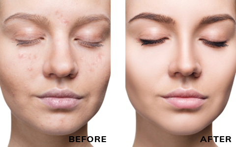 Before After Case - 1