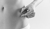 Coolsculpting