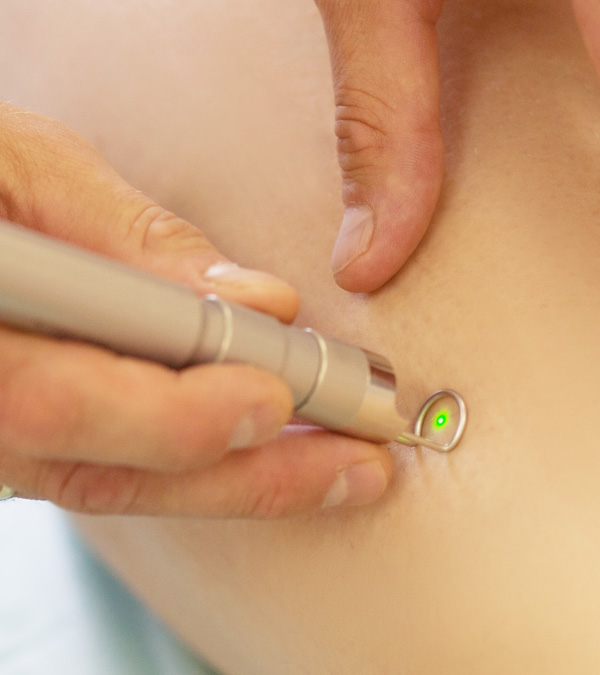 Laser Surgery