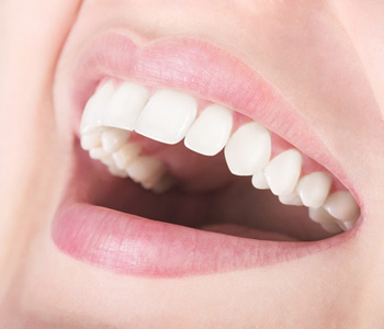 Smiley Teeth