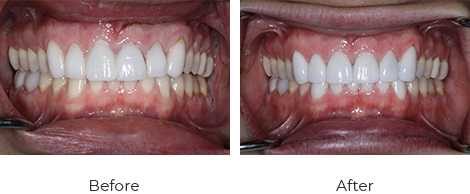 Andrew Pack before/after