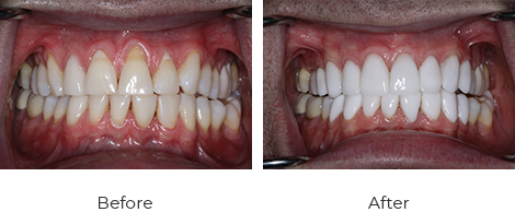Chris Munday before/after