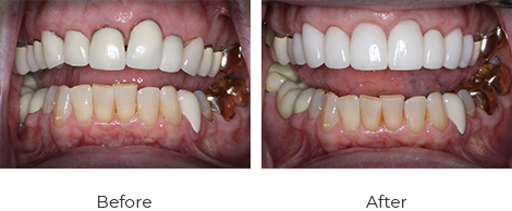 Kay Johnson before/after