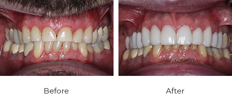 Shawn Ronson before/after