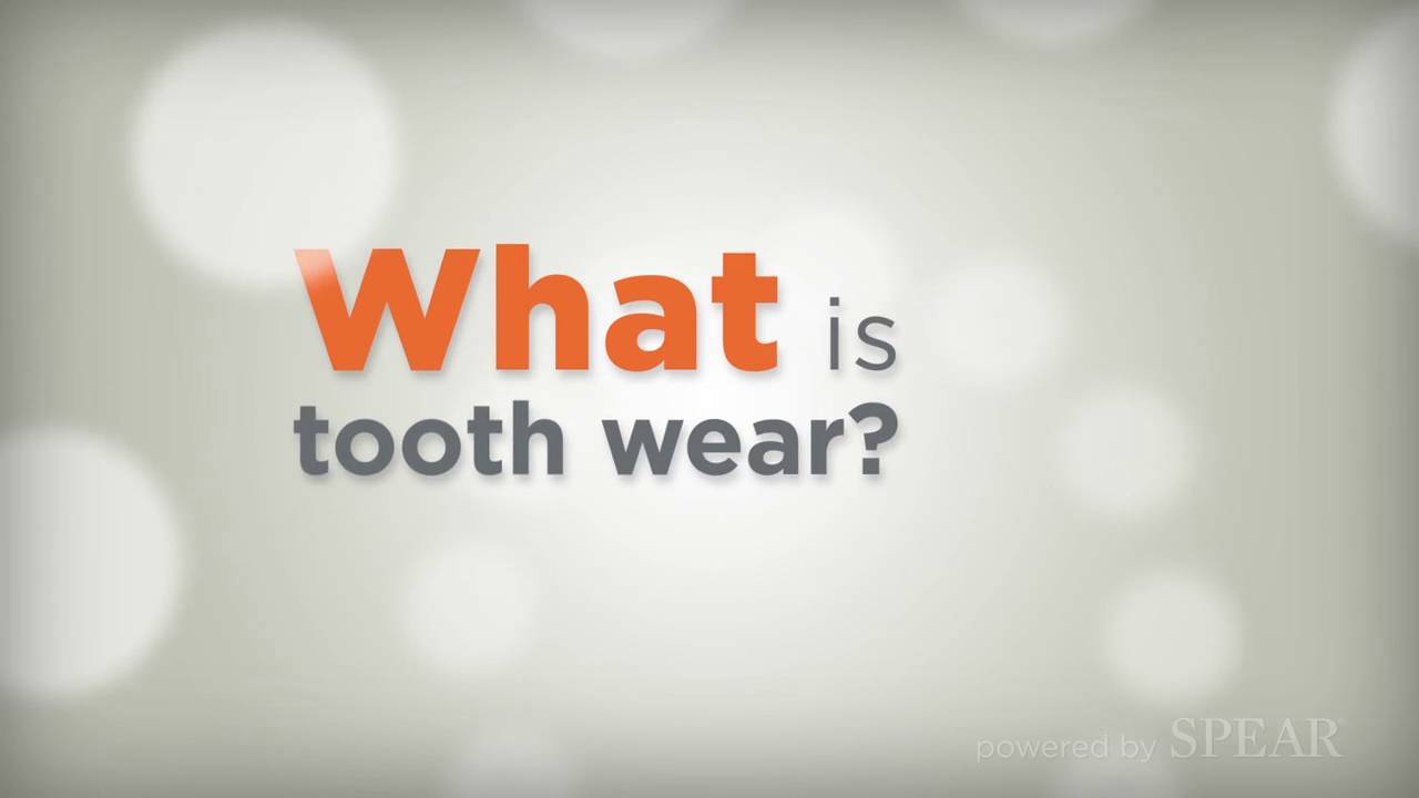 What is Tooth Wear