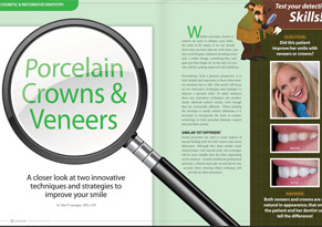 Porcelain Crowns & Veneers