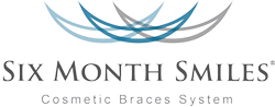 Smile Make Over Longview - Six Month Smile