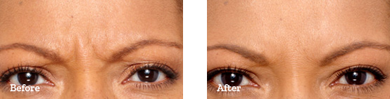 Before After image 02