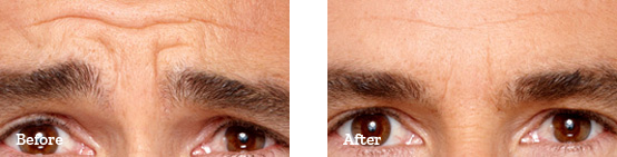Before After image 03