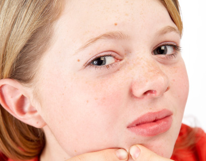 Teenage girl picking at acne