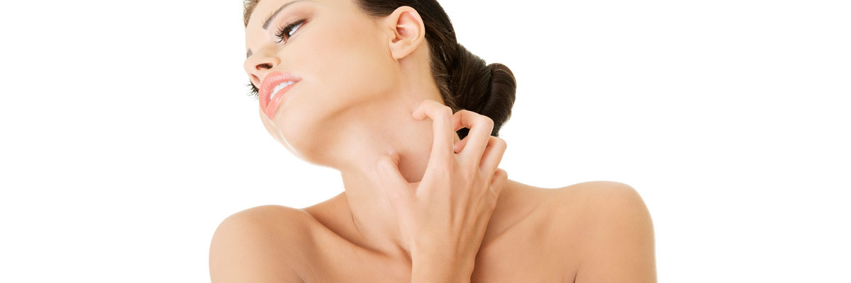 Eczema