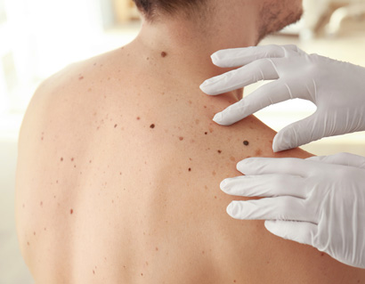 Dermatologist examining patient in clinic