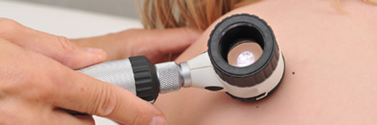 Skin cancer checkup