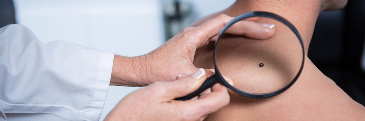 a man getting checked for skin cancer