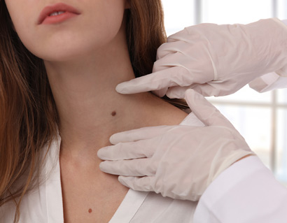 Doctor dermatologist examines birthmark of patient close up. Checking benign moles