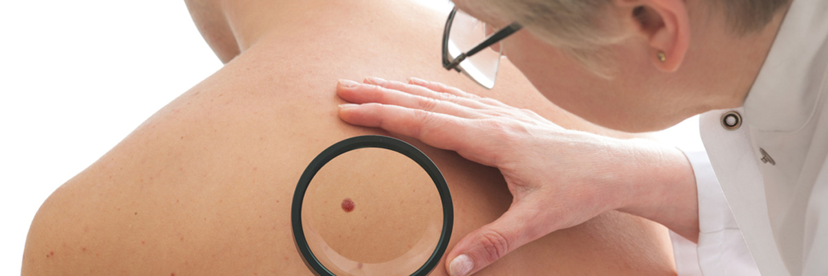 Dermatologist examining mole