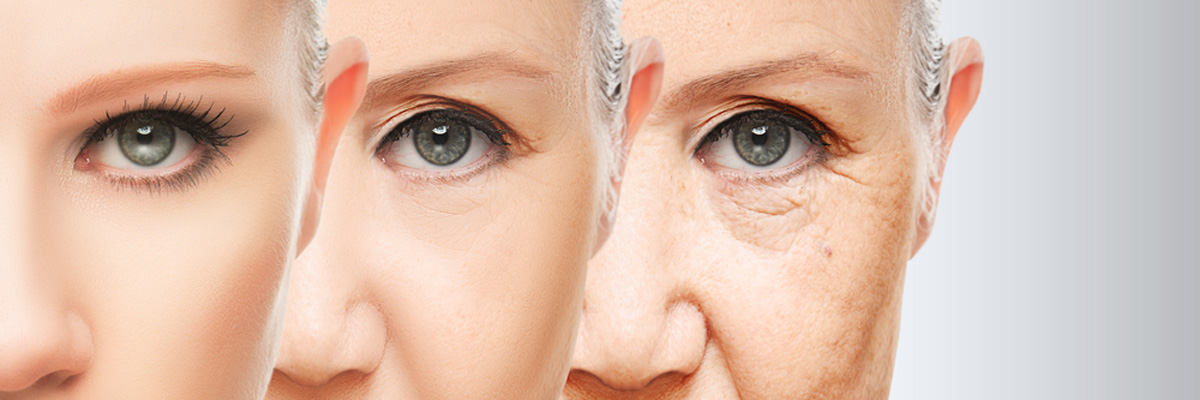 Women's aging of skin