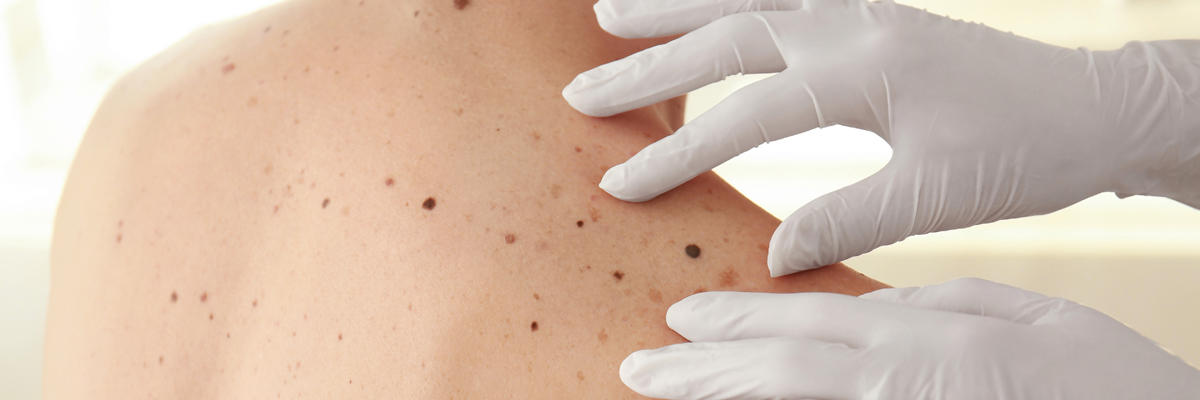 Dermatologist examining patient in clinic