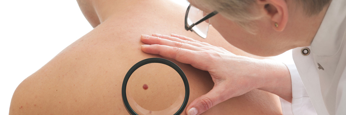 Dermatologist examines a mole of male patient