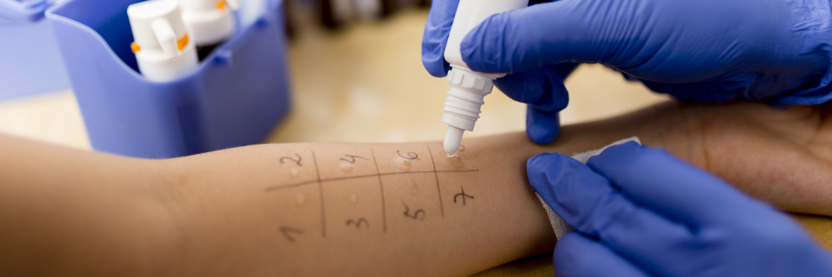 Allergy - skin prick tests