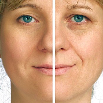 Renew your skin with laser rejuvenation