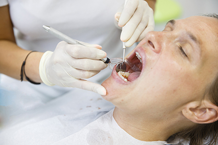 Patient at Dental Hygienists, Endodontics Las Vegas
