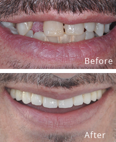 Before After Case - 3