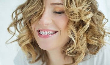 A girl with braces