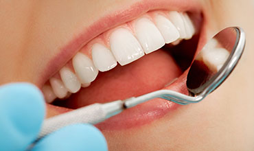 Mouth checkup