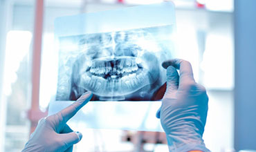 Dental Xray