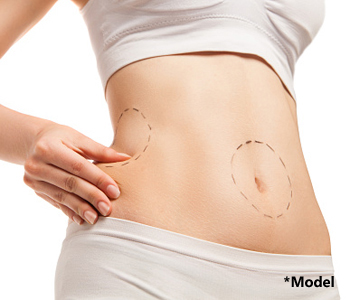 SmartLipo provide skin tightening benefits in beverly hills