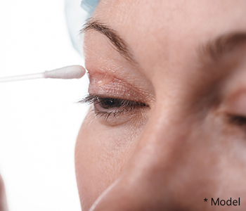 Dr Dass describes upper eyelid surgery