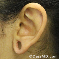 Dr Dennis Dass, MD Before case 1-1