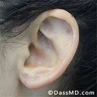 Dr Dennis Dass, MD After case 1-1