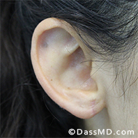 Dr Dennis Dass, MD After case 1-3