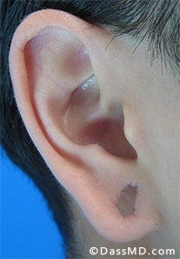 Dr Dennis Dass, MD Before case 3-1