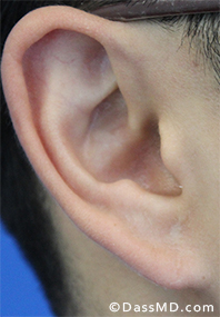 Dr Dennis Dass, MD After case 3-1