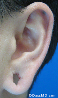 Dr Dennis Dass, MD Before case 3-2