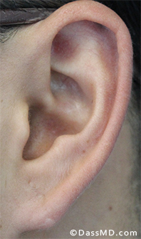 Dr Dennis Dass, MD After case 3-2