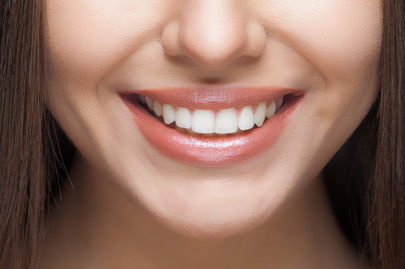 Why patients in Calumet City, IL, may need crowns for their teeth